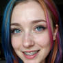 Freckled Braceface