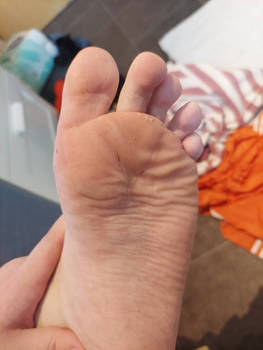 filthy wrinkles feet