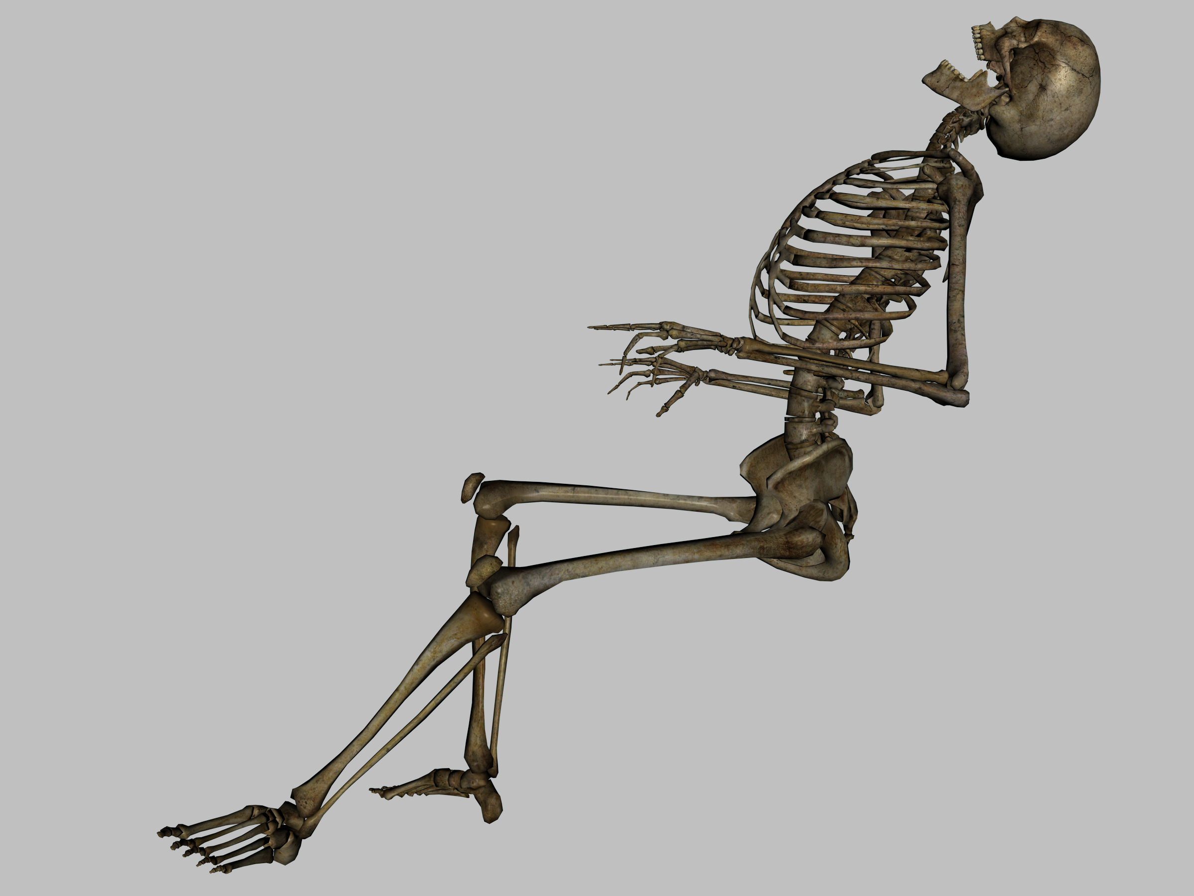 Skeleton Dead - JPG
