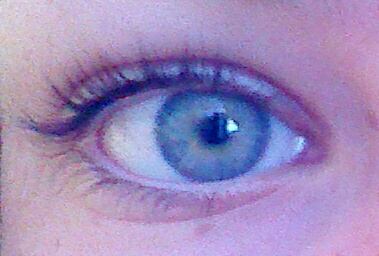 my eye when its not edited.