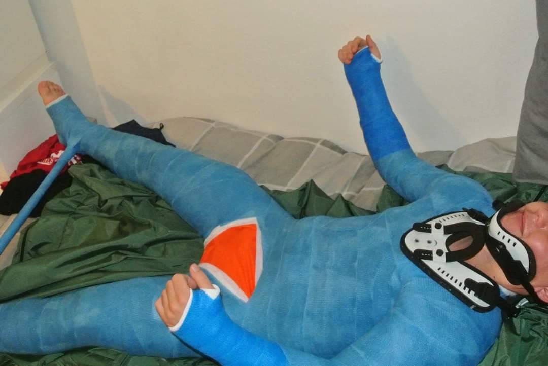 Neck Cast neck brace + blue body cast by voidReala on DeviantArt