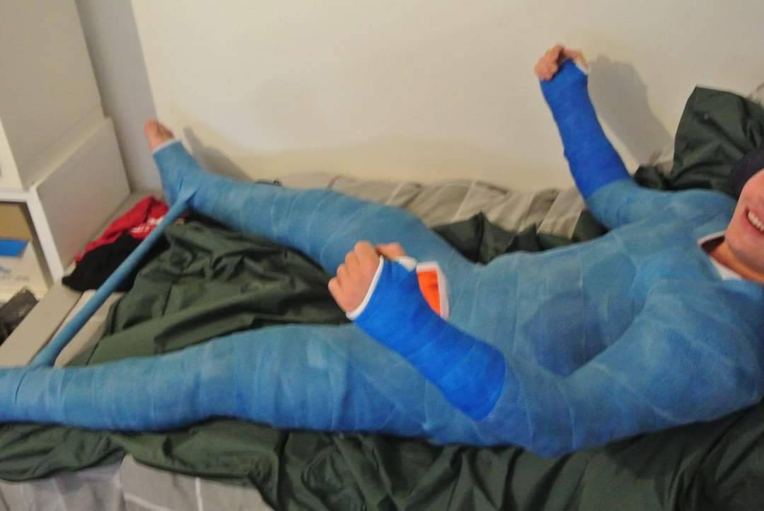 blue full body cast by voidReala on DeviantArt