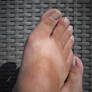 summersun on my feet 2