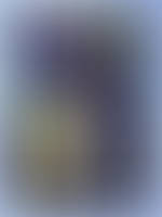 Vincent et le triple contacts