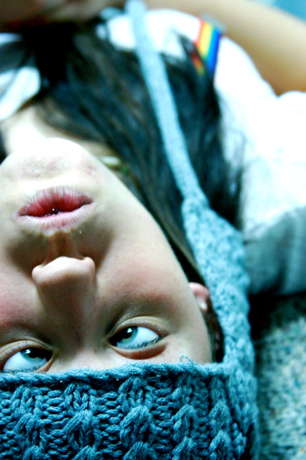 cross-eyed.
