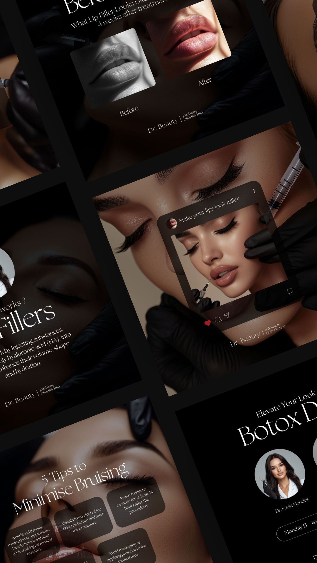 Botox Anonymous 200 Botox Filler Social Media Templates Instagram by AleksCel on DeviantArt