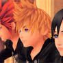 OMG its Xion