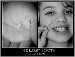 The lost tooth