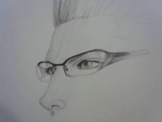 Ignis eye practice