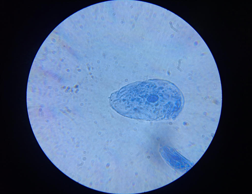 Stained Cheek Cell by SwagHaters on DeviantArt