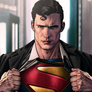 Superman David Corenswet Shirt Rip