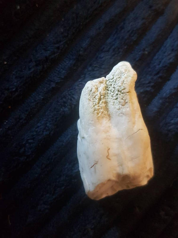 mystery tooth 3 by rainbow-falls on DeviantArt
