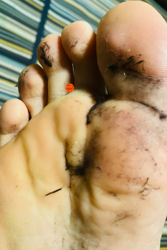 Dirt and the sun