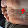 Dry foot