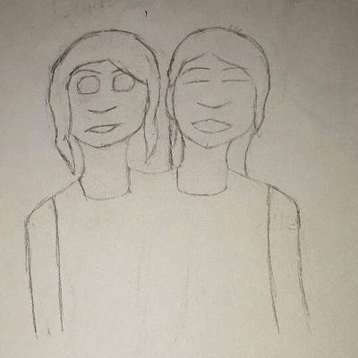 Conjoined twins by CharlieMakara on DeviantArt