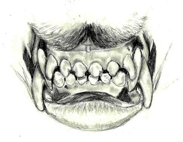 Canine teeth front view by celestriastars on DeviantArt