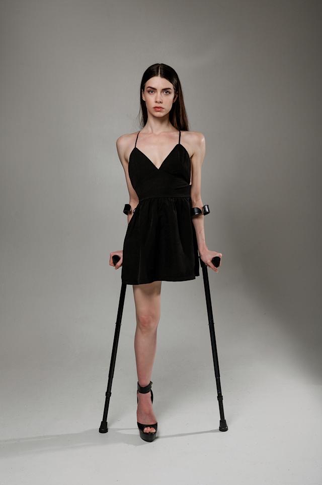Leg Modification Deviantart Amputee model by toeamputee on DeviantArt
