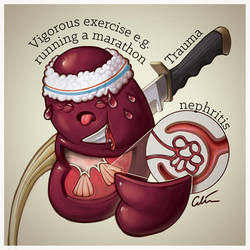 Haematuria causes #1 by cilein