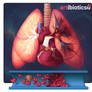 Thrombus