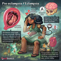 Pre-eclampsia illustrated