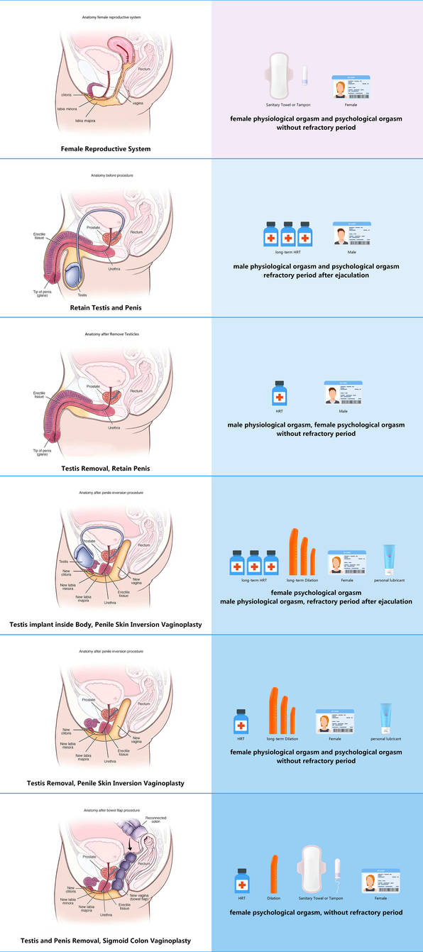 Gender Nullification Male-to-female Sex Reassignment Surgery by FeLily82 on DeviantArt