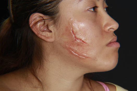 face scar makeup