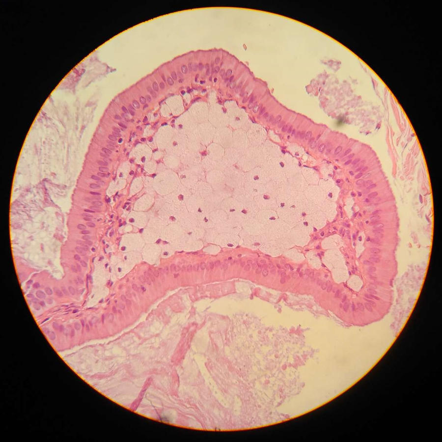 Planet Polyp by KingsOfEvilArt on DeviantArt