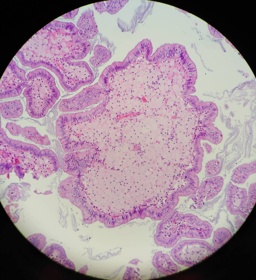 Planet Polyp II by KingsOfEvilArt on DeviantArt