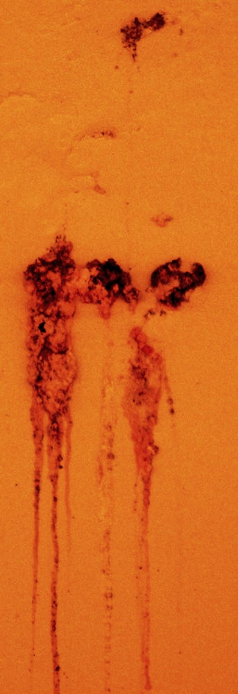 Lesions by emaciate on DeviantArt