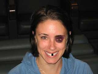 Casey Anthony1