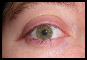 I Eye