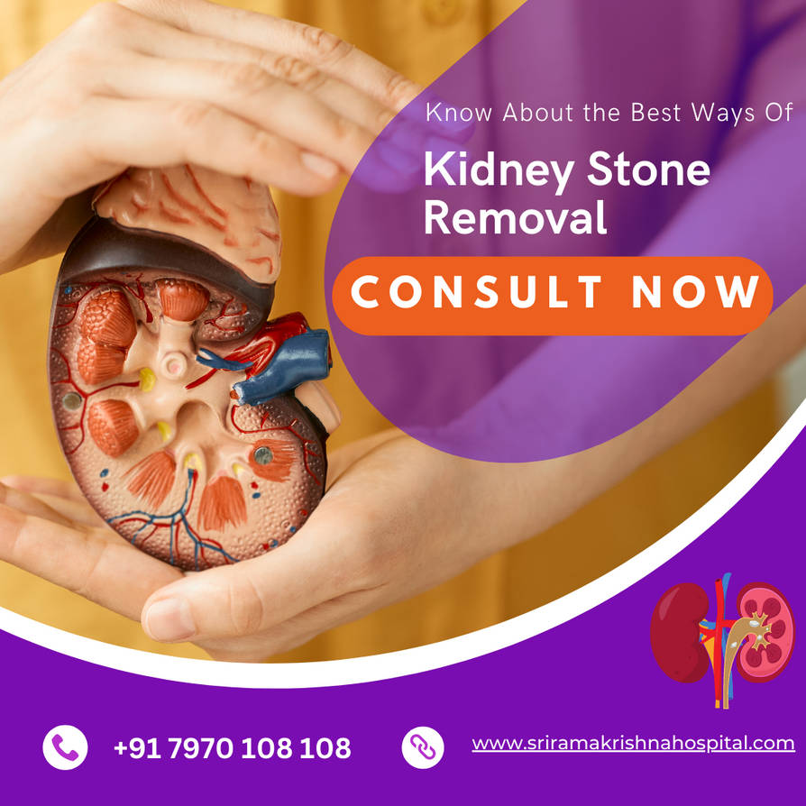 Kidney Stone Removal by BarshaBarsha on DeviantArt