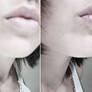 Big lips.
