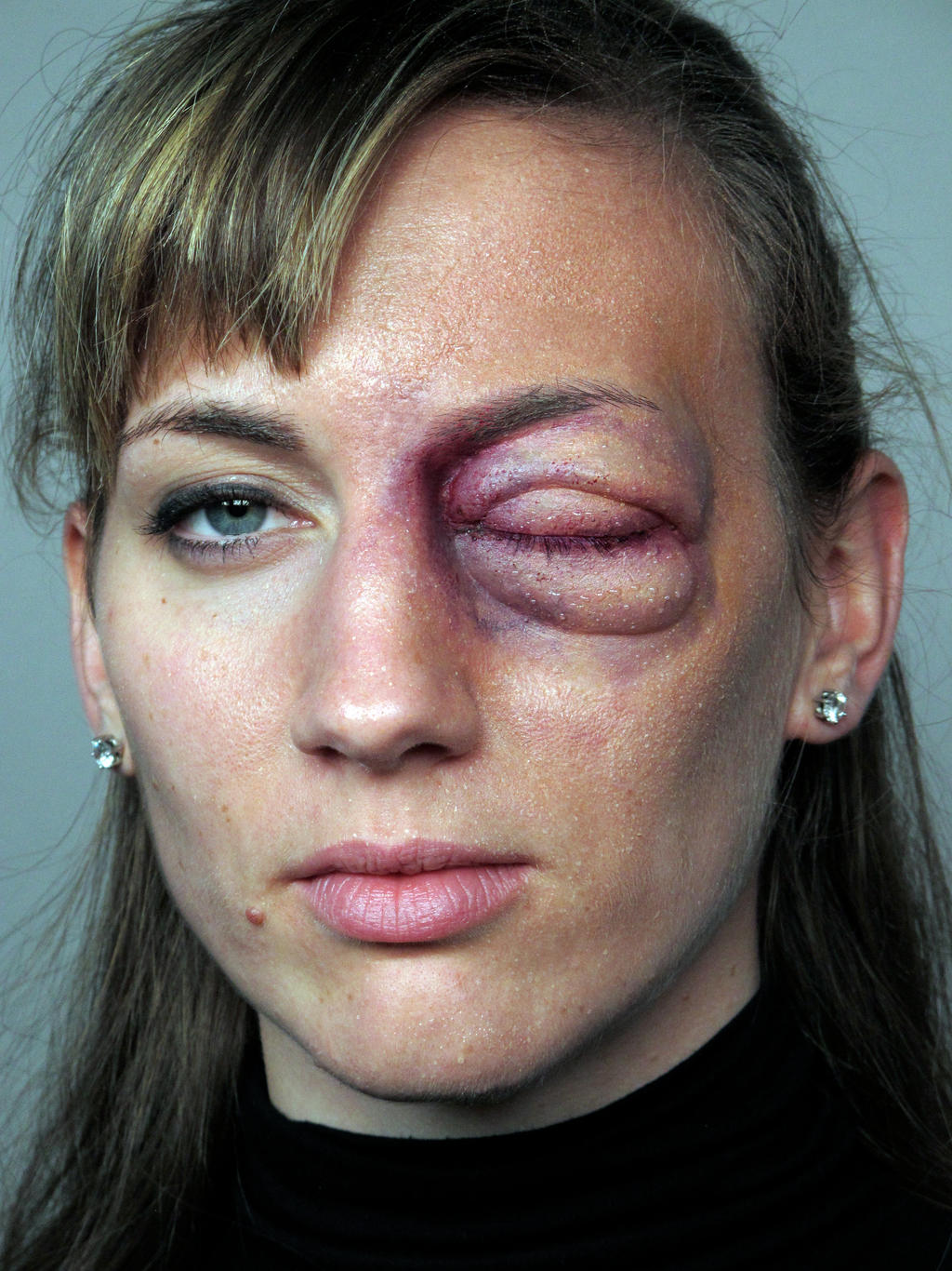 Swollen Eye Prosthetic Makeup