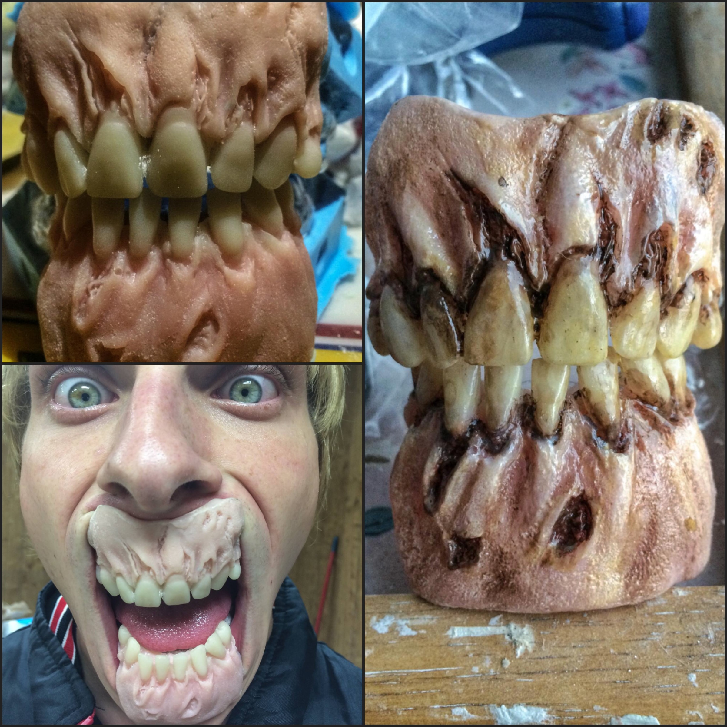 Rot Jaw Dentures