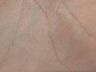 skin texture - hand