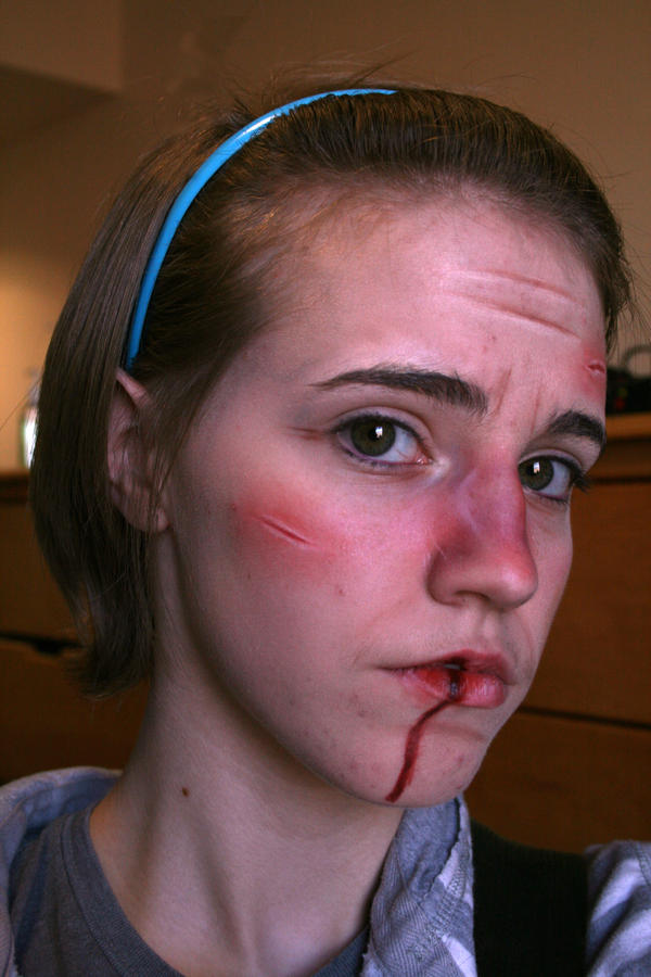 Bruises-Cuts 4: Stage Makeup by KleptoPyroManiac on DeviantArt