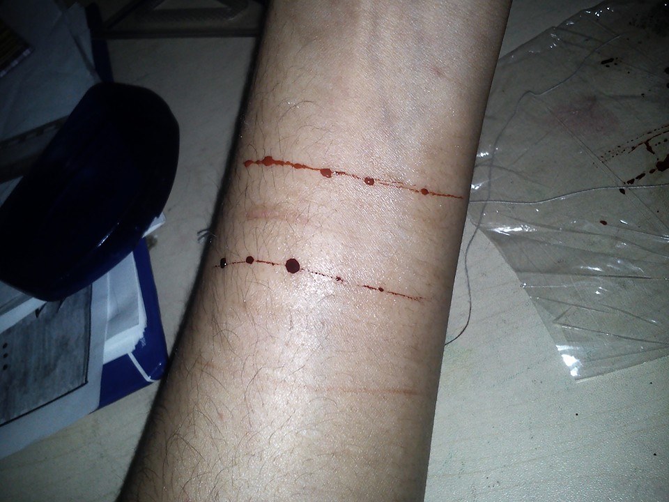 Fake Hand Cut Experiment By Floriyon On Deviantart