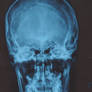 Skull X-Ray