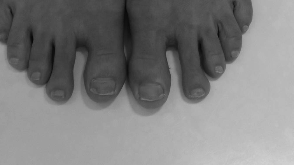 Deviantart Counting Toes Toes. by blotevoetendroom on DeviantArt
