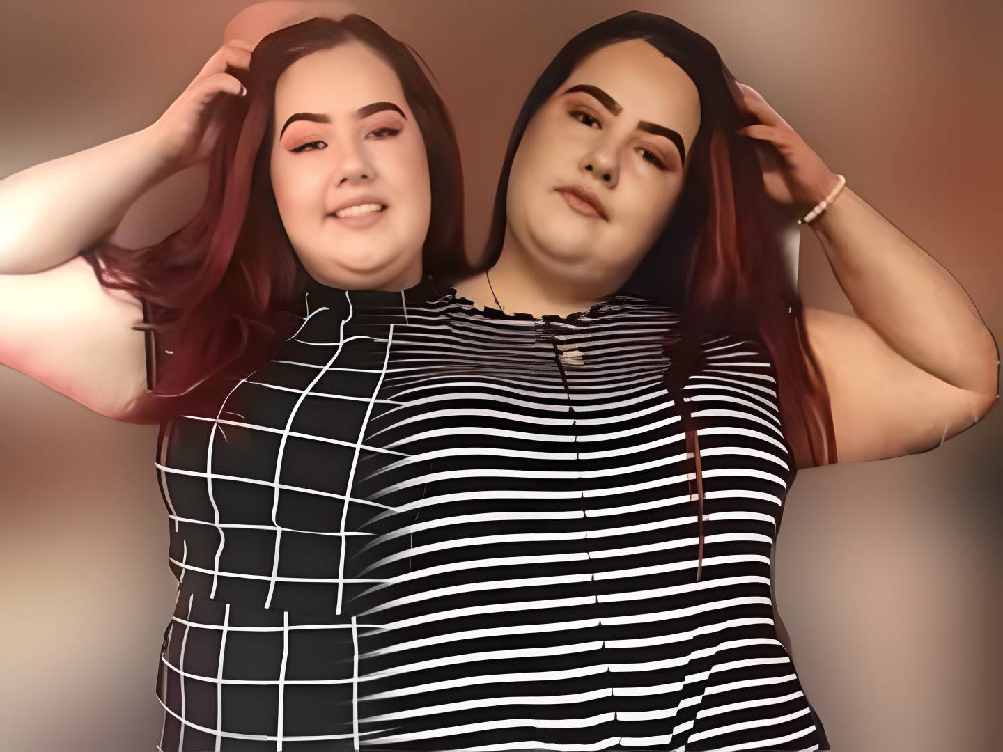 Conjoined twins by Ulta228 on DeviantArt