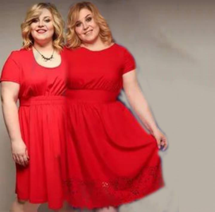 Conjoined twins by Ulta228 on DeviantArt