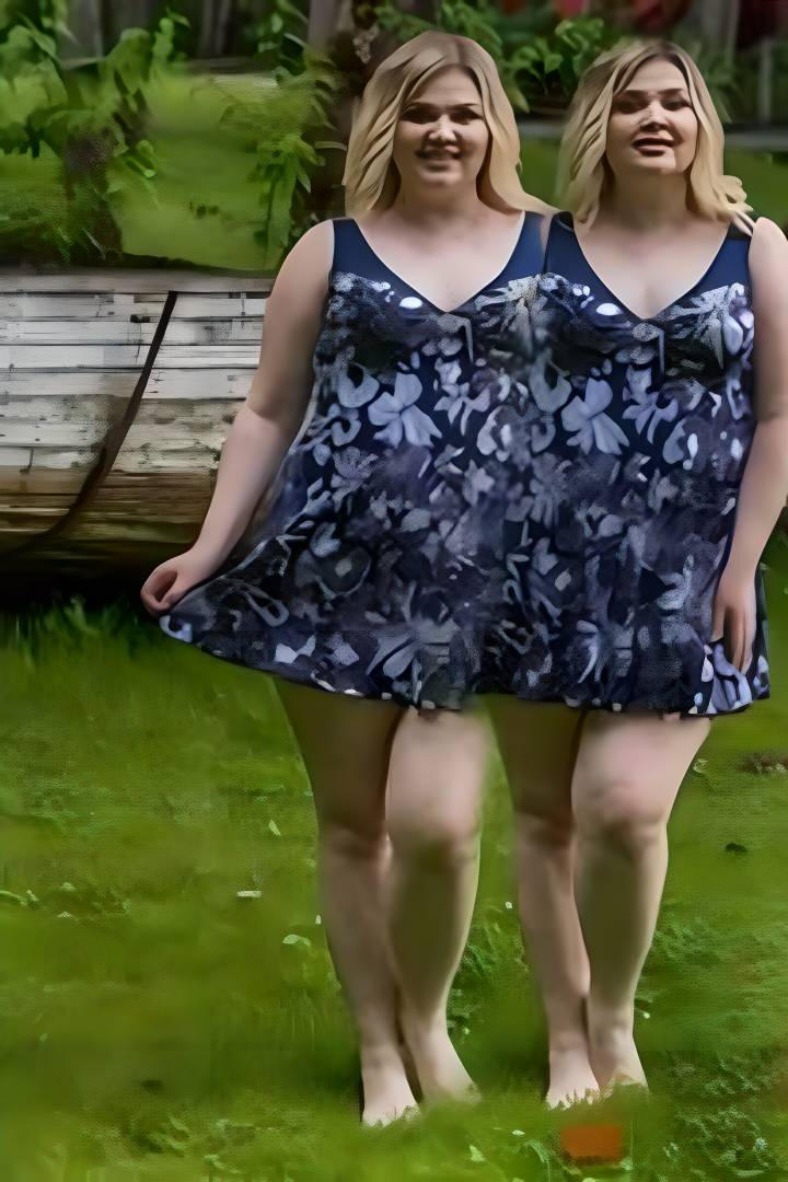 Conjoined twins by Ulta228 on DeviantArt