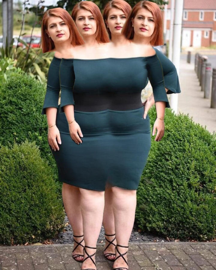 Conjoined twins by Ulta228 on DeviantArt