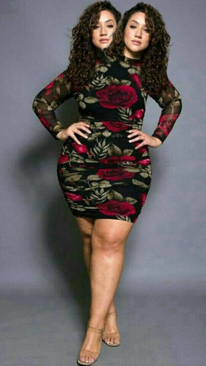 Conjoined twins by Ulta228 on DeviantArt