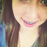 Braces e.e