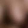 Breast