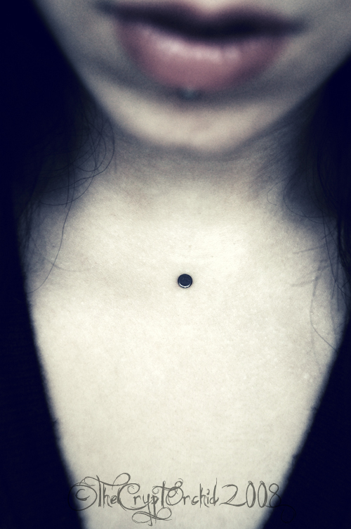 my sub-dermal anchor