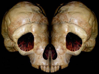 Skull