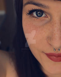 Freckles